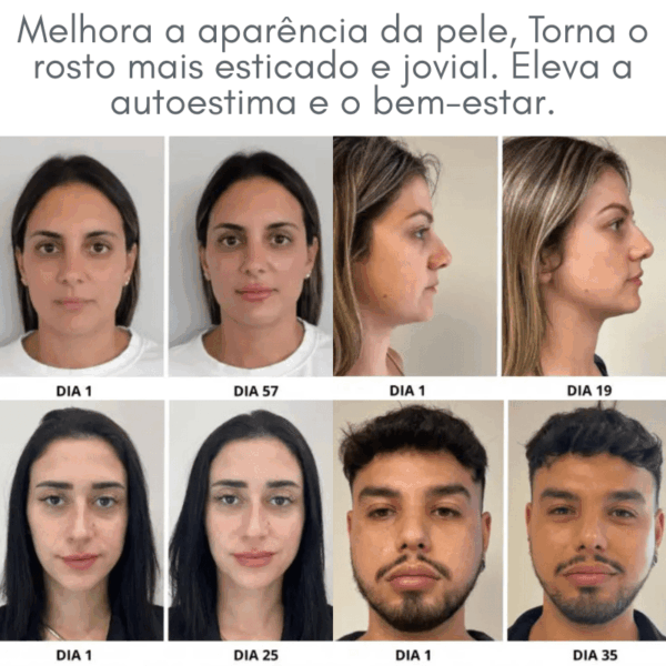 Face Glow 2.0® - Definição e Rejuvenescimento + Brinde - Imagem 6